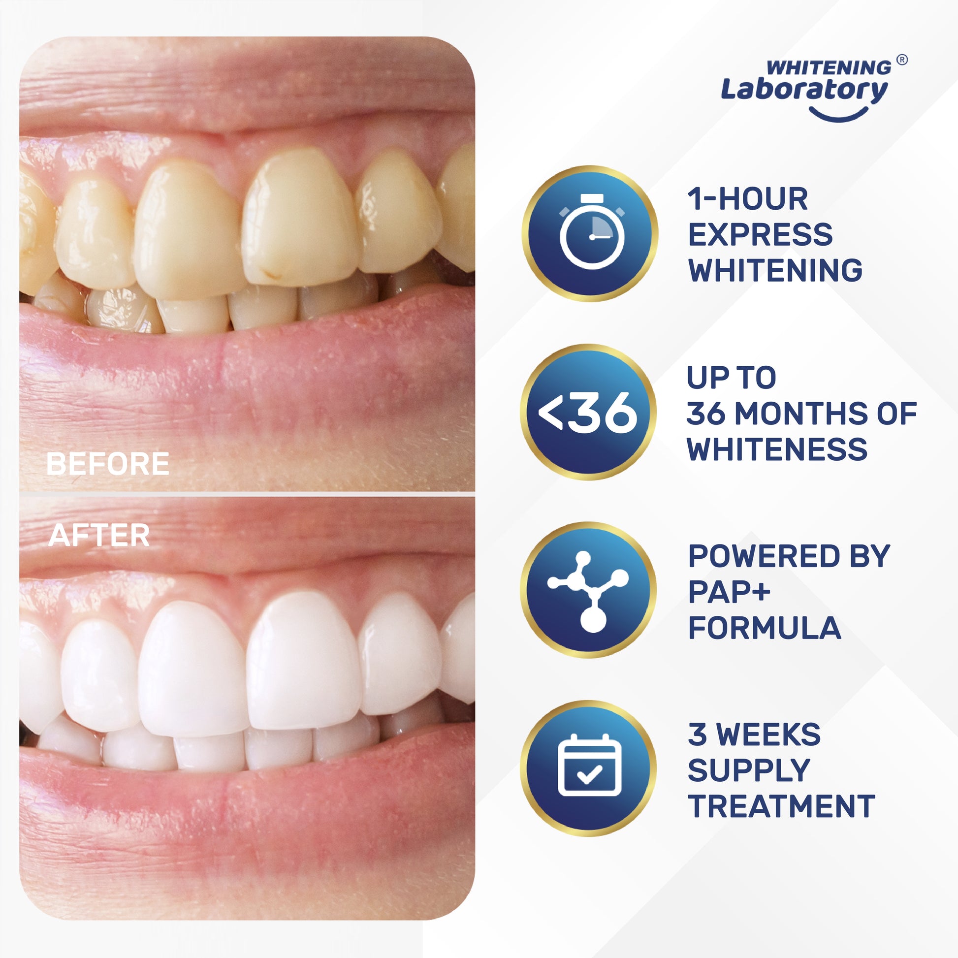 Before and after comparison of teeth whitening results with Whitening Laboratory strips, demonstrating effectiveness over a 3-week treatment period.